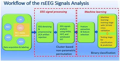 A holo-spectral EEG analysis provides an early detection of cognitive decline and predicts the progression to Alzheimer’s disease